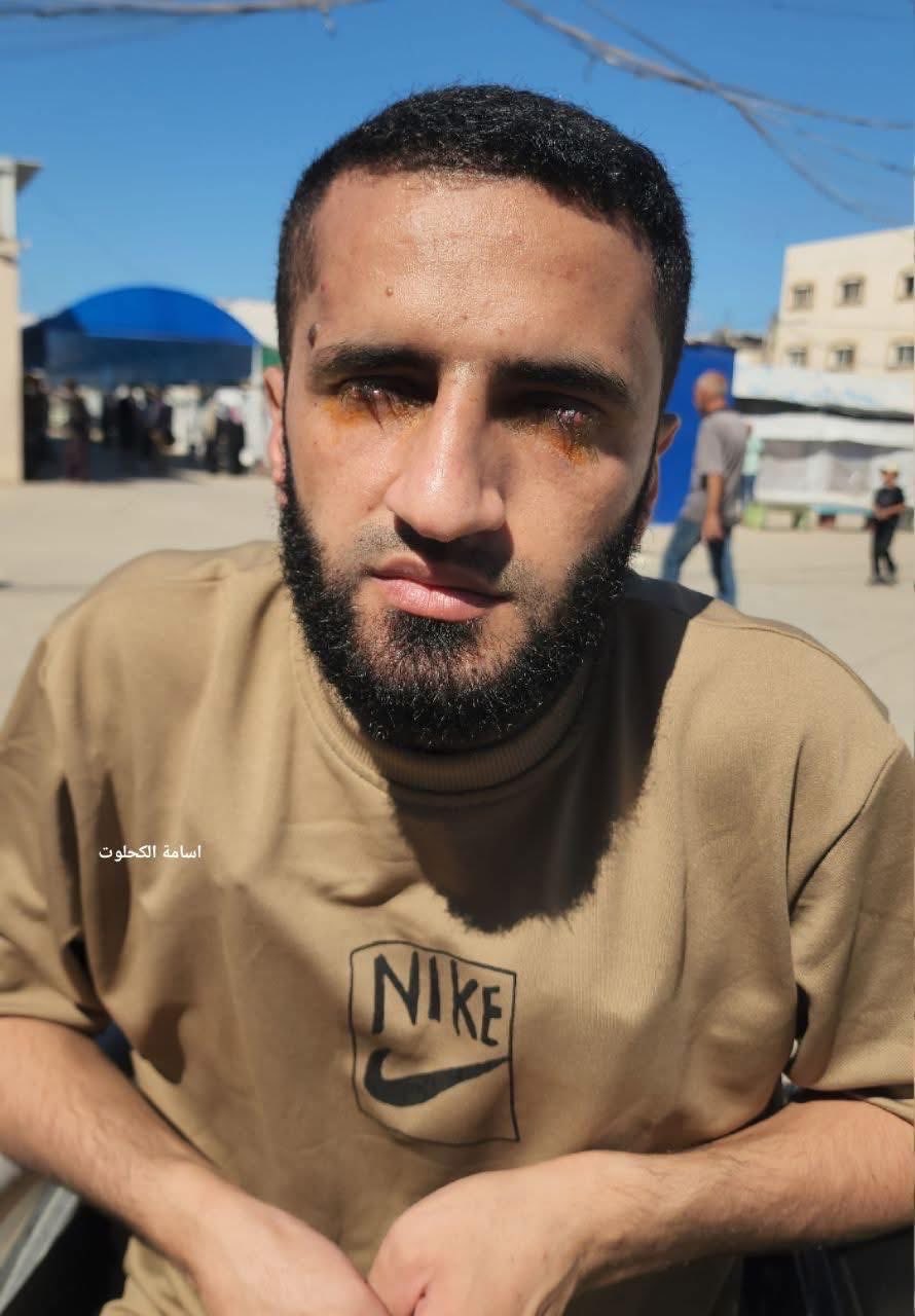 الوحشية الإسرائيلية بأبهى صورها!