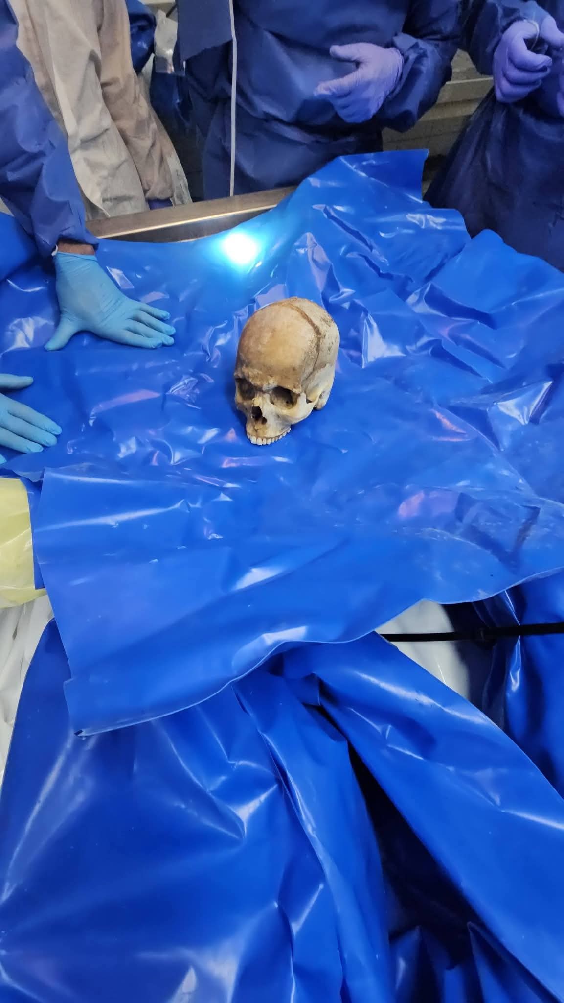 مشاهد مرعبة لجثامين الشهداء المحتجزة!