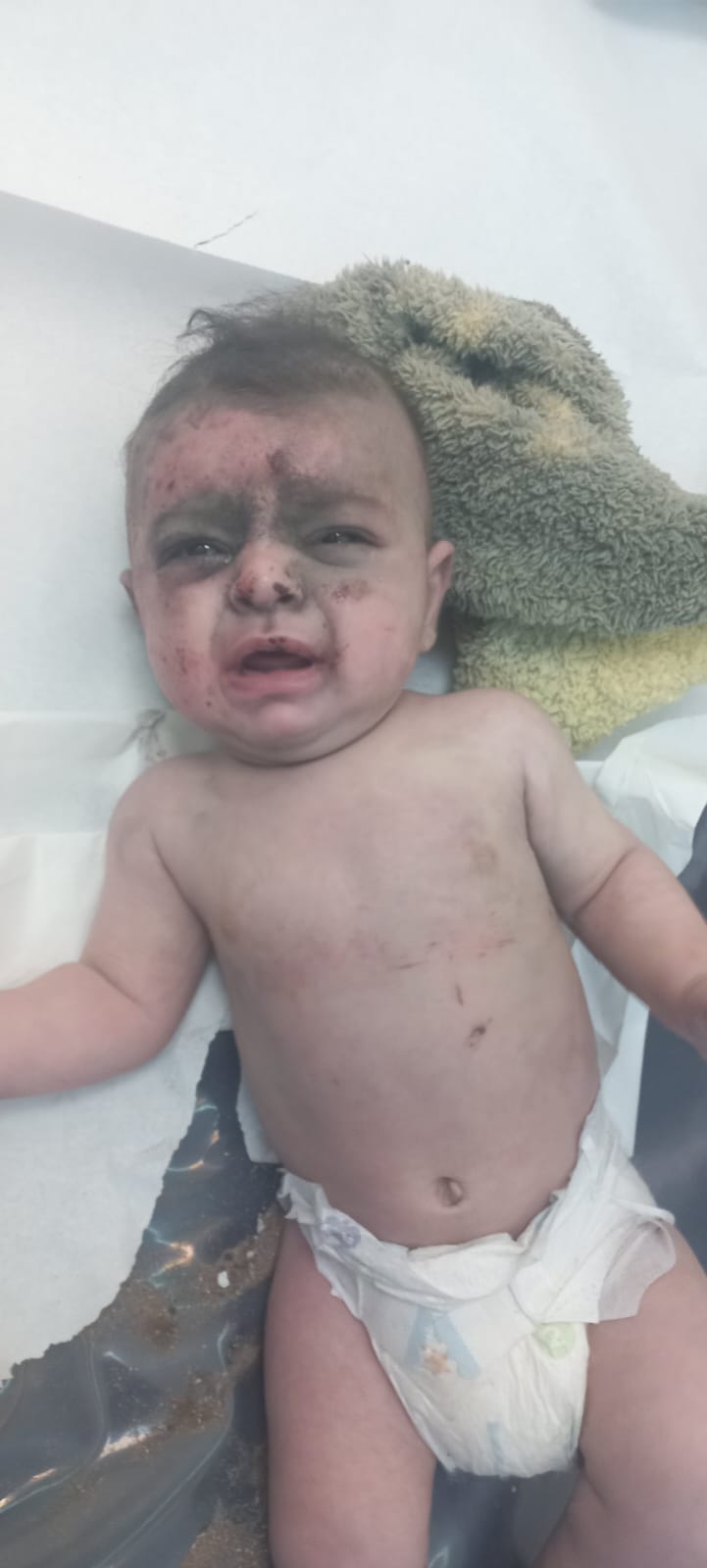 جنون “العدو الصهيوني وارتكابه لمجازر في صيدا وبيروت والضاحية والجنوب!!واكثر من 300 شهيد وجريح