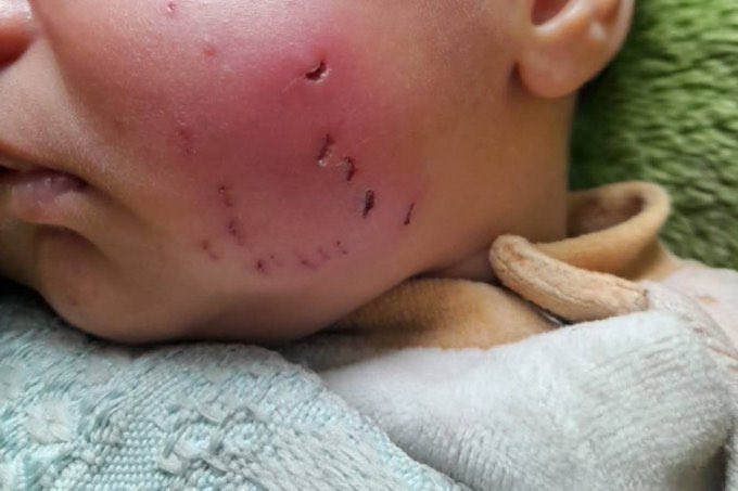 الفئران والقوارض تهاجم الأطفال في غزة!
